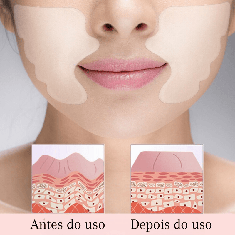 Adesivos Antirrugas FitBotox®